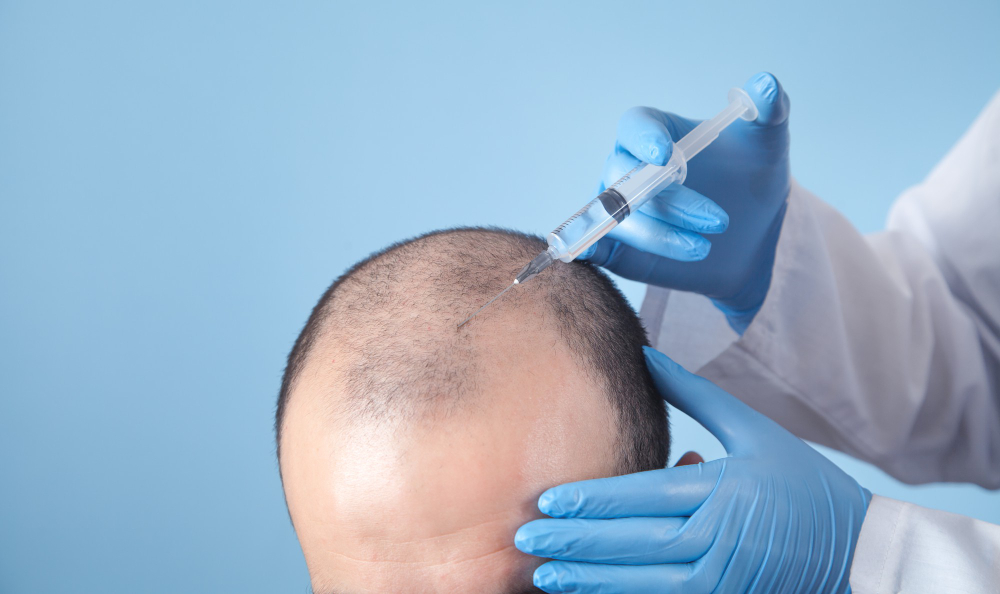 FUE Hair Transplantation (Follicular Unit Extraction)